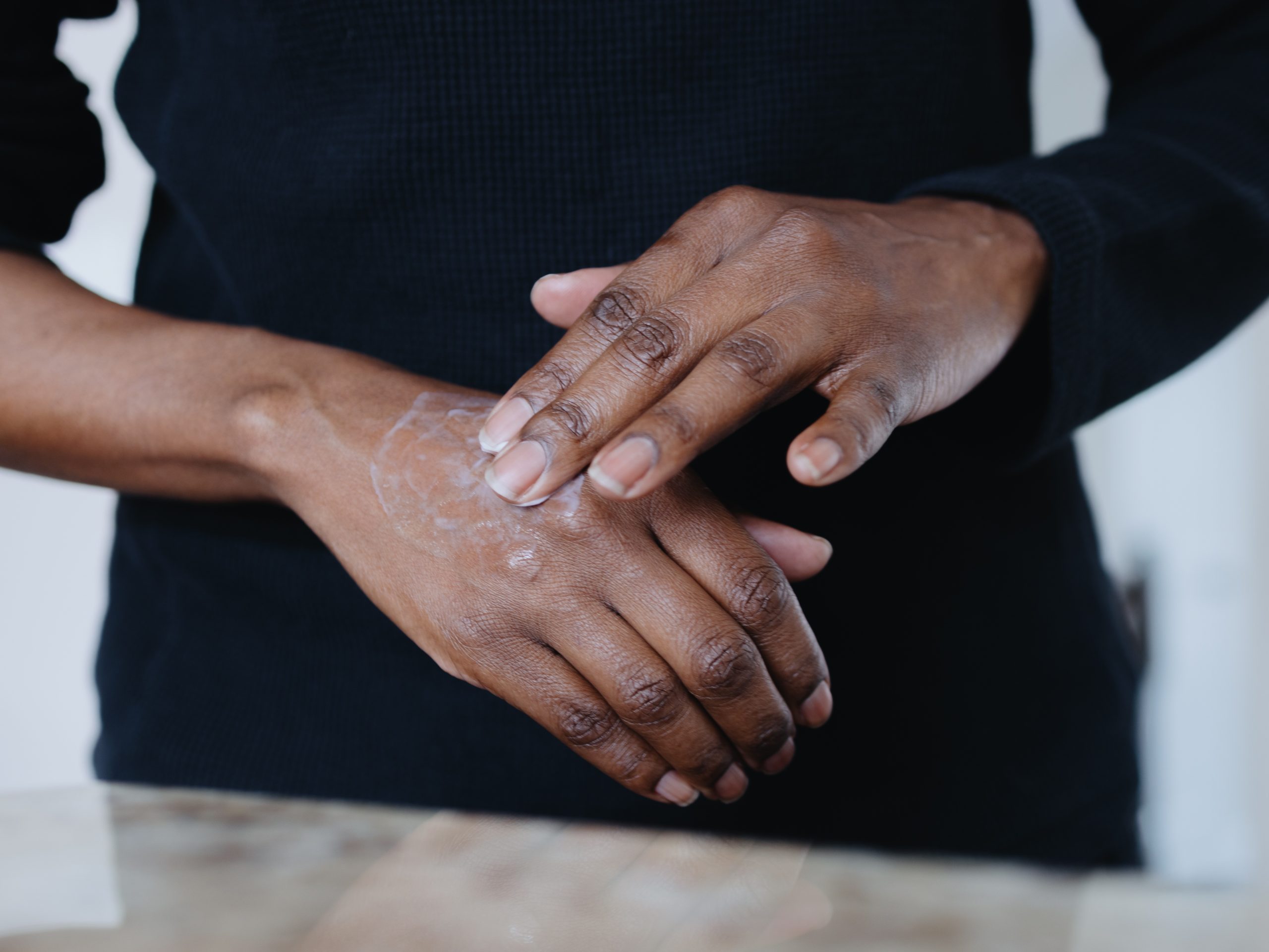 Your Hands Deserve A Skincare Routine Too: How To Fade Stubborn Dark Spots Fast